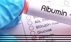 Albümin Nedir? Albümin Yüksekliği ve Düşüklüğü Ne Anlama Gelir?