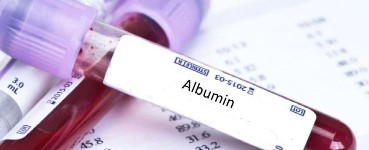 Albümin Nedir? Albümin Yüksekliği ve Düşüklüğü Ne Anlama Gelir?