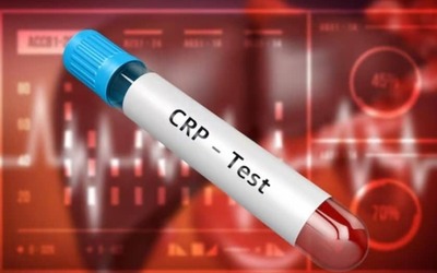 CRP Yüksekliği Belirtileri