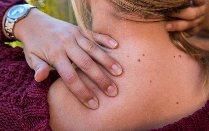 Rotator Cuff kasları nedir? Rotator Cuff sendromu nedir?